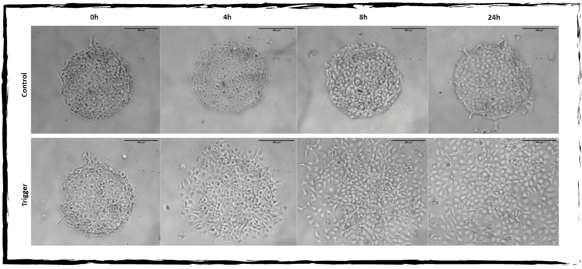 Cell migration on micropattern