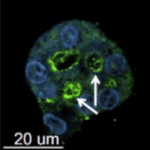 HepaRG spheroid