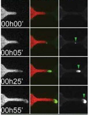 HeLa cells on microchannels