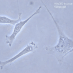 Phase contrast microscopy image of fibroblasts from a mouse embryo