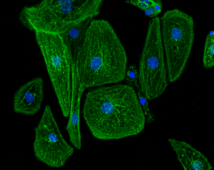 STD_18 zoom hPSC-CM cells