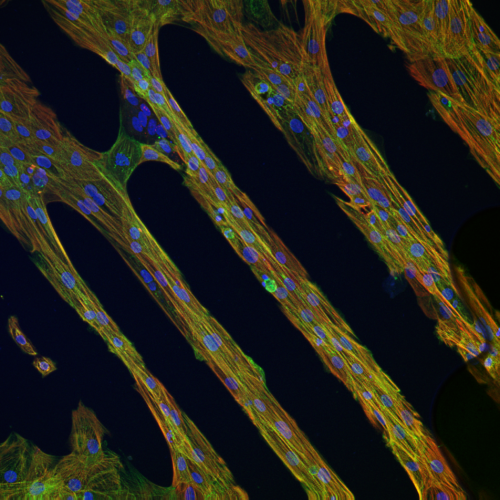 micropatterns cardiomyocytes