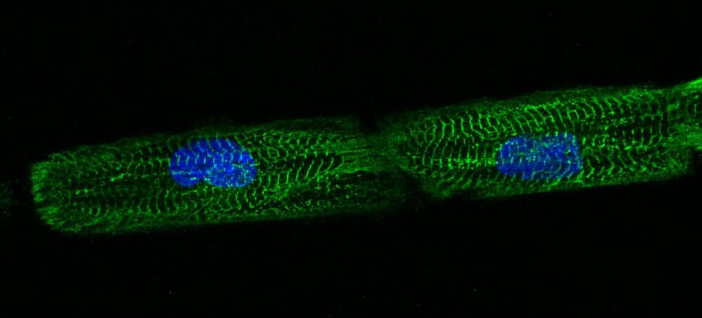 micropatterned hPSC-CM