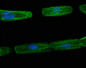 micropatterned cells