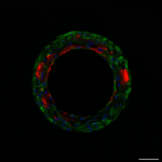 Smartheart bottom Troponin Vimentin DAPI