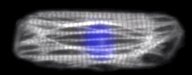 cardiomyocytes micropattern