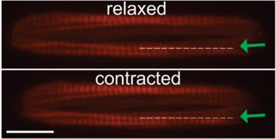 cardiomyocytes pattern