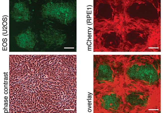 coculture microscopy images