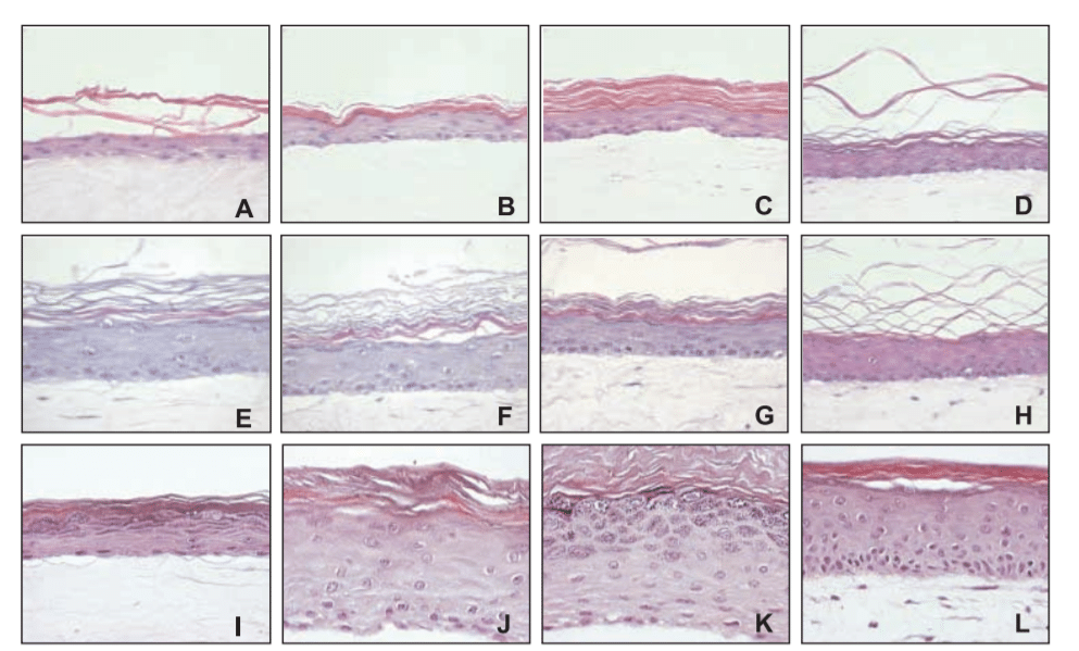 Reconstructed epidermis with different culture conditions