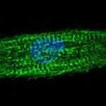 Cardiomyocyte